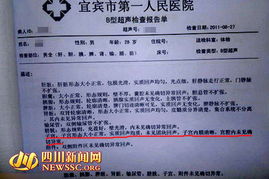 b超檢查報告單(B超檢查多少錢)