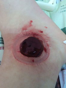 腳扭傷之后作文開頭