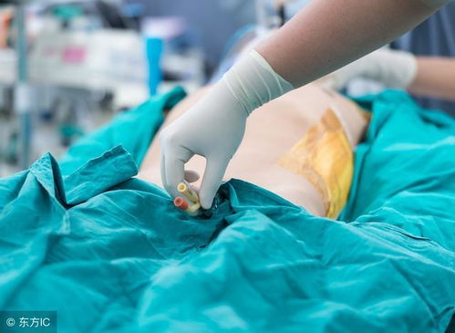 護(hù)理操作導(dǎo)尿注意事項(xiàng),基礎(chǔ)護(hù)理男性導(dǎo)尿注意事項(xiàng),導(dǎo)尿的護(hù)理措施和注意事項(xiàng)