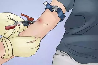 靜脈血采集注意事項