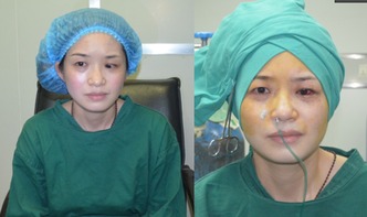 斜視手術(shù)前注意事項眼藥水,斜視手術(shù)后注意事項,斜視手術(shù)恢復(fù)期注意事項