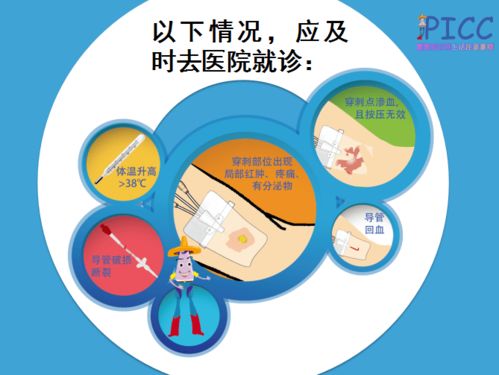 dj管拔除后注意事項,雙j管拔除后注意事項,picc管拔除后注意事項