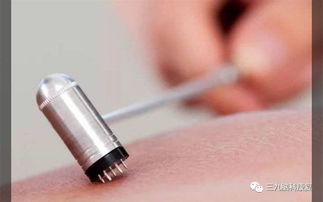 刺絡(luò)注意事項