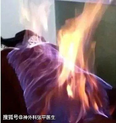 火療的步驟及注意事項,火療之后注意事項,火療的目的及注意事項