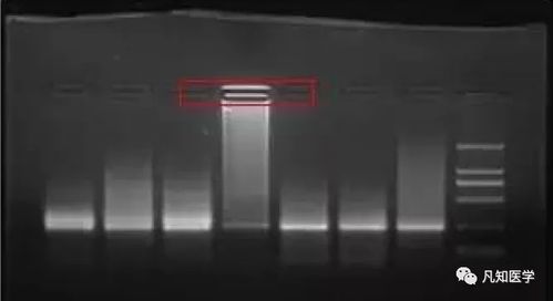 電泳,注意事項,實驗