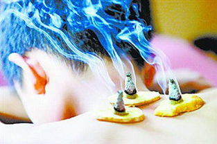 隔姜灸后的注意事項(xiàng)