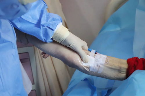 注意事項(xiàng),picc,置管時(shí)