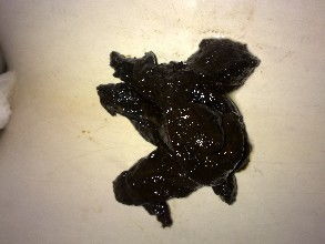 大便黑色注意事項