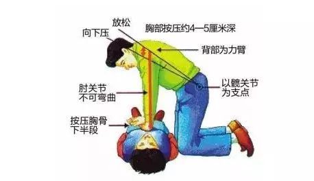 按壓,簡(jiǎn)述,注意事項(xiàng)