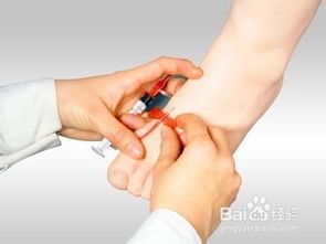 輸液,注意事項(xiàng),技術(shù)