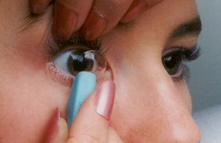 角膜,注意事項,塑形