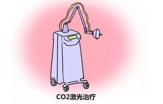 尖銳濕疣激光治療后注意事項