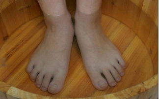 脈管炎術(shù)后注意事項