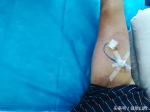 手臂,注意事項(xiàng),picc