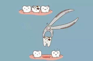 拔智齒前注意事項(xiàng),拔立事牙后注意事項(xiàng),拔立事牙注意事項(xiàng)與禁忌癥