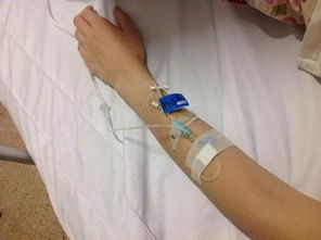 寶寶扎留置針注意事項,貓咪扎留置針注意事項,留置針的護理及注意事項