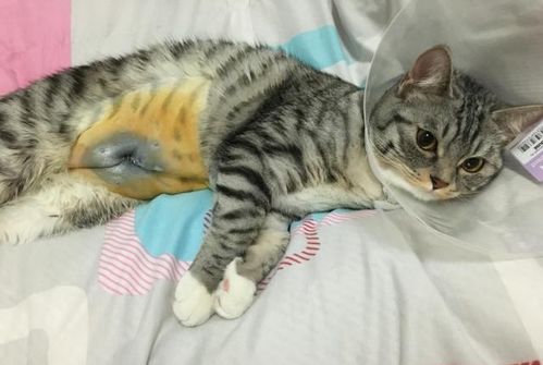 節(jié)育,注意事項