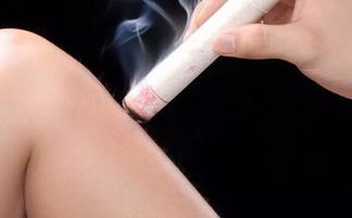 艾灸后注意事項(xiàng),艾灸做完后的注意事項(xiàng),艾灸后注意事項(xiàng)和禁忌癥