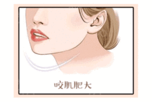 微整形術(shù)后注意事項(xiàng)