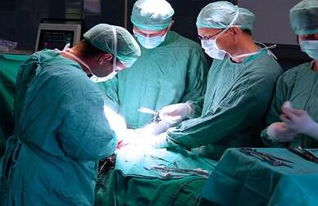 息肉,宮頸,手術后,注意事項