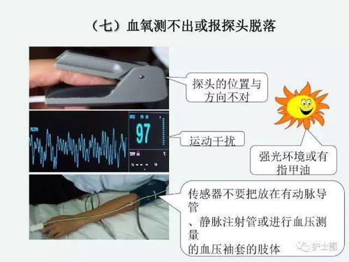 監(jiān)護(hù),注意事項,心電
