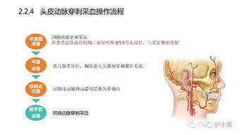 血?dú)?標(biāo)本,時應(yīng),注意事項