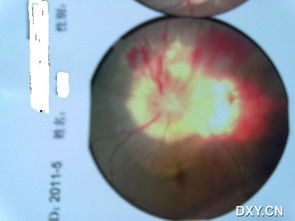 牽?；ňC合癥注意事項