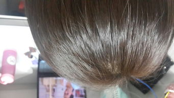 拉頭發(fā)后注意事項