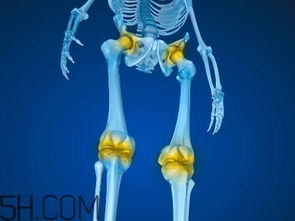 肺部積水注意事項,輸卵管積水注意事項,腎結(jié)石積水飲食注意事項