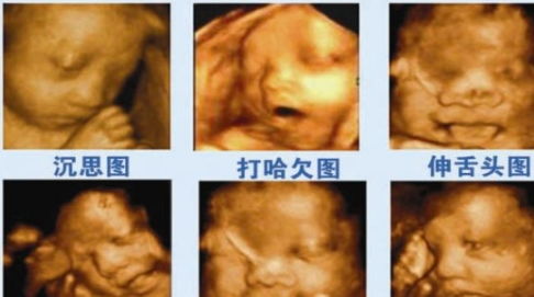 做肝臟彩超注意事項(xiàng)