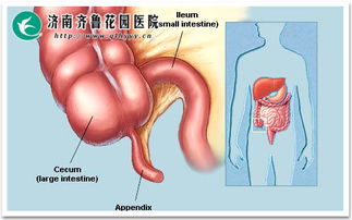 闌尾炎,五歲,手術(shù)后,注意事項(xiàng)