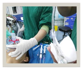 簡述,氣管,注意事項,插管