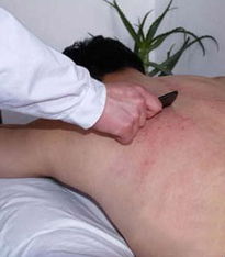 在家刮痧注意事項