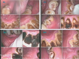 口腔放射防護注意事項,放射防護注意事項,放射檢查注意事項