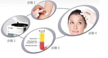 注射自體美容PRP后的注意事項(xiàng)