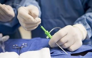 輸卵管造影檢查前需要注意什么,輸卵管造影前注意事項(xiàng)有哪些,輸卵管造影術(shù)前需要注意什么