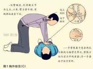 簡(jiǎn)述胸外按壓注意事項(xiàng)