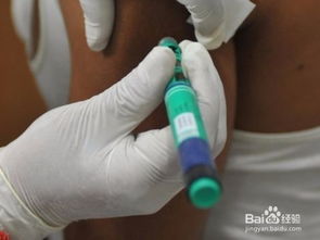 育苗,狂犬,注意事項(xiàng)