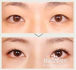 割雙眼皮需要注意哪些問題,雙眼皮術(shù)前術(shù)后注意事項(xiàng),做雙眼皮前后注意事項(xiàng)有哪些