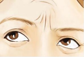 川字紋填充后注意事項