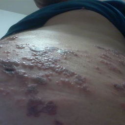 纏身龍注意事項(xiàng)