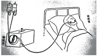 鼻飼,昏迷,注意事項,患者