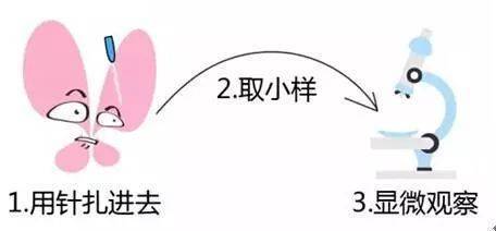 男性hpv檢查前注意事項(xiàng),男性檢查HPV注意事項(xiàng),HpV檢查注意事項(xiàng)