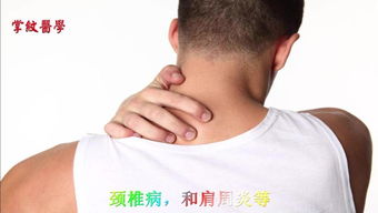 注意事項(xiàng),治療,蛇盤瘡