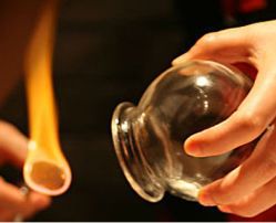 寇氏拔罐減肥親身經(jīng)歷,寇氏拔罐減肥有效嗎,寇氏拔罐減肥原理