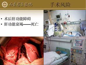 肝纖維瘤注意事項(xiàng)