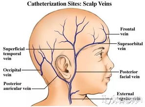 注射,小兒,頭皮,注意事項