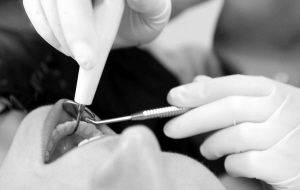 智齒拔牙注意事項與禁忌癥,智齒拔牙手術(shù)注意事項,智齒拔牙縫針后注意事項