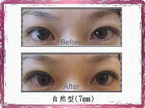 睫毛,注意事項(xiàng)