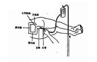 清潔灌腸法注意事項(xiàng)有哪些